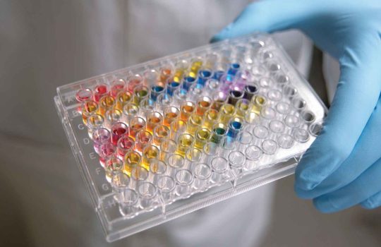 Enhancing Drug Safety: The Role of Liver Toxicity Testing2